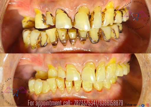 Get your teeth cleaned this winter and be free from bad breathe, bleeding gums and sensitivity. C… post image