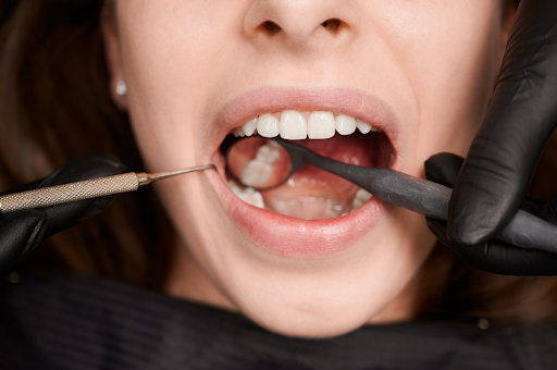 LIHE, Dentista Monterrey - Thumbnail