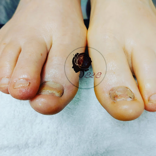 Beast 2 Beauty Bar Medi Spa - Thumbnail