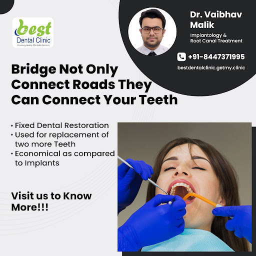 Missing front teeth, can't bite an apple, Speak to dentist now and get bridges to complete your s… post image