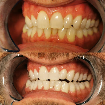 White and Beauty wybielanie zębów Leszno