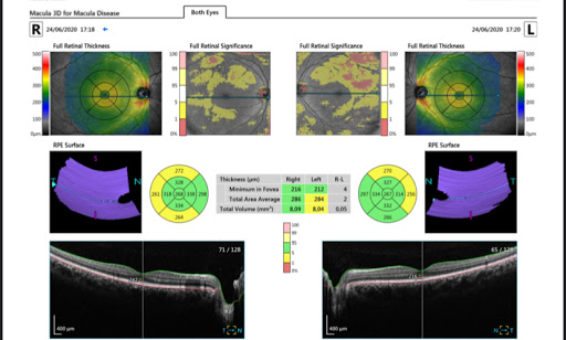 Centro Diagnosi Oculare - Thumbnail