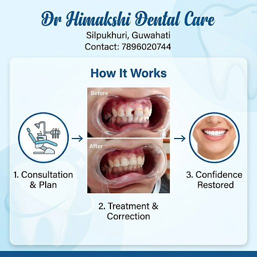 Restored front tooth 🦷 post image