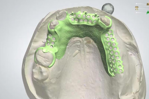 South Shore Dental Laboratory Gallery - United States