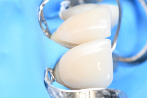 Photo n°5 de Dr Antoine Leuret - Esthétique dentaire, facettes, implants dentaires, chirurgie des gencives à Bordeaux (Dentiste cosmétique)