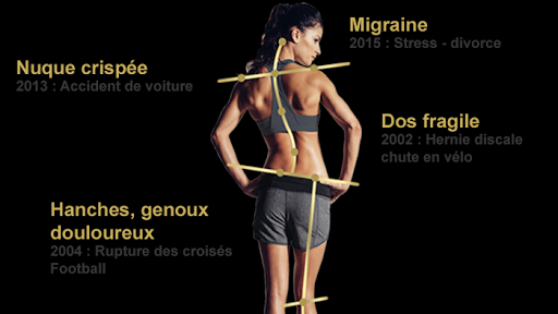 Clinique de posturologie - Josépha Michler Leblanc - Bilan de posture - Rééducation posturale méthode Mézières - Thumbnail