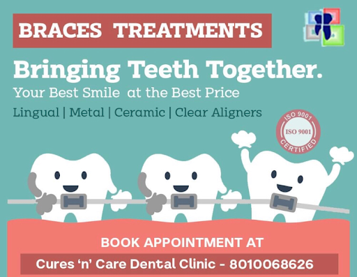 100% off on digital scan for aligners