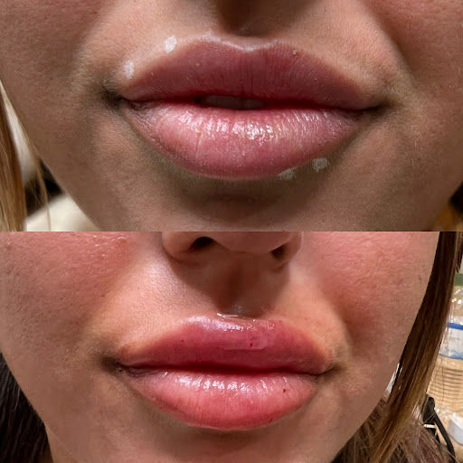 BBeautiful Injectables