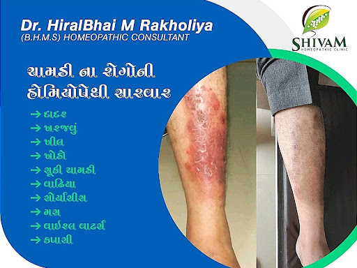 http://shivamhomeopathic.in post image