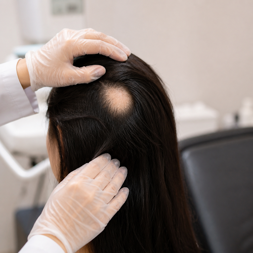 Hair thinning, patchy hair loss or sudden shedding can be worrying, but timely treatment makes a… post image