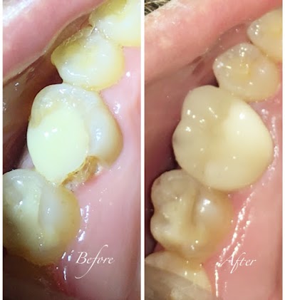 Photos of Osaka dental care / klinik gigi Osaka / Drg. Ivana Yap