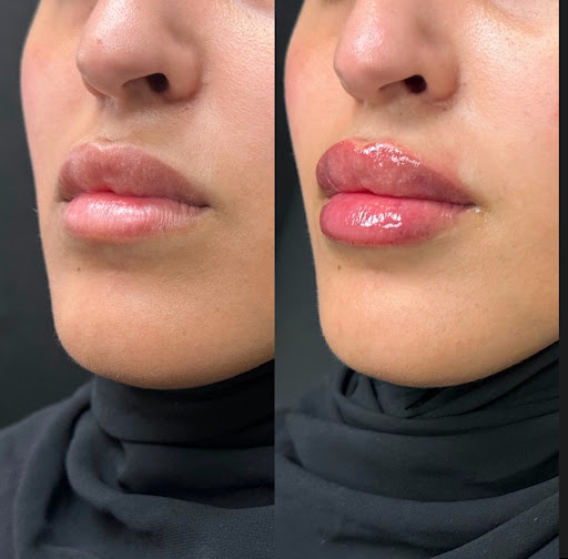 AESTHETICSBYALIAA