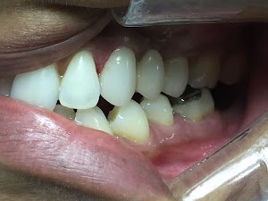 Dentista en Miraflores Lima Peru: Odontodigital 5