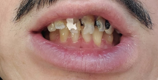 Pueblo Del Sol Dental