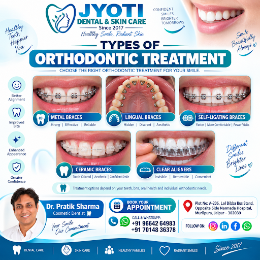 क्या आपको लगता है कि टेढ़े-मेढ़े दाँतों को ठीक करने का मतलब सिर्फ Metal Braces है? 🤔 post image