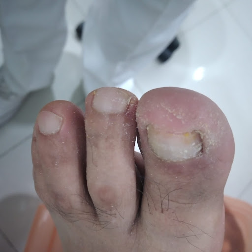Pro active feet - Thumbnail