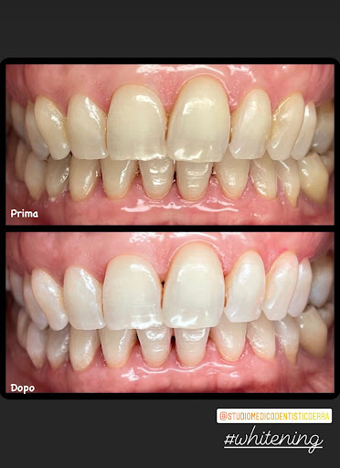 Studio Dentistico Dr. Erra - Thumbnail