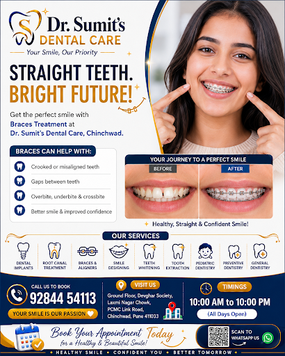 #Dentist #chinchwad #Pimprichinchwad post image