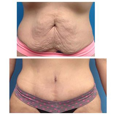 la Piel Perfecta laser center - Thumbnail