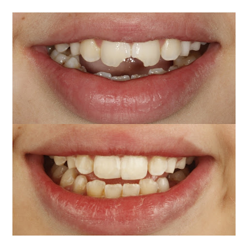 CAB Rehabilitacion oral e implantes - Thumbnail