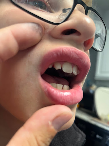 Highwood Dental Studio Gallery - United States