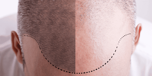 New Jersey Hair Restoration Center - Thumbnail