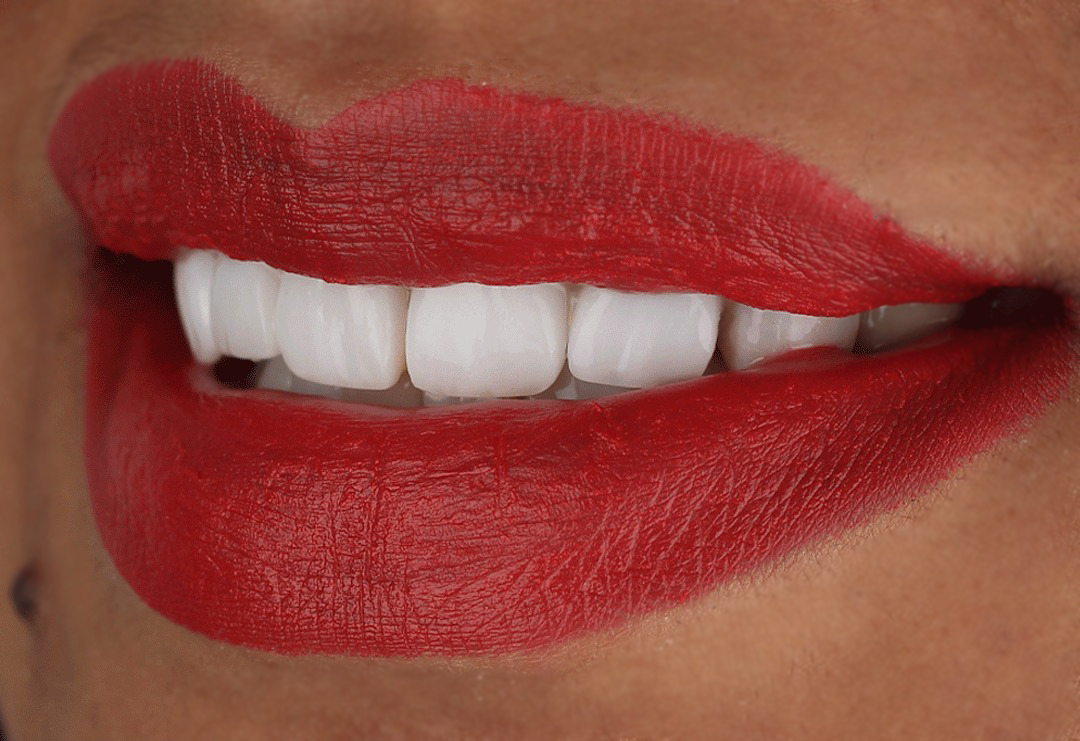 المهيدب لطب الأسنان,الستين(الأحساء) - صورة 2