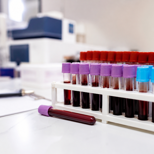 Looking for a reliable blood test lab in Malad West that goes beyond basic reports? Our advanced… post image