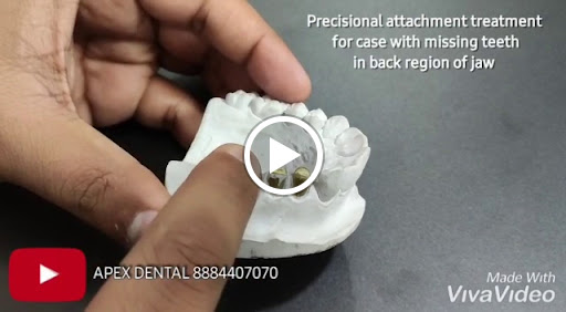 APEX DENTAL GULBARGA post image