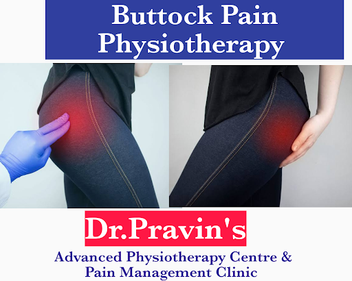 Buttock Pain Physiotherapy post image