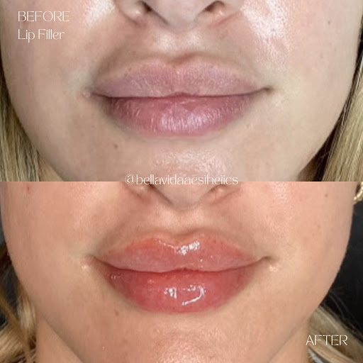 Bella Vida Aesthetics & Wellness