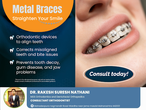 Struggling with crooked teeth, noticeable gaps, or bite problems? Braces can help! They gradually… post image