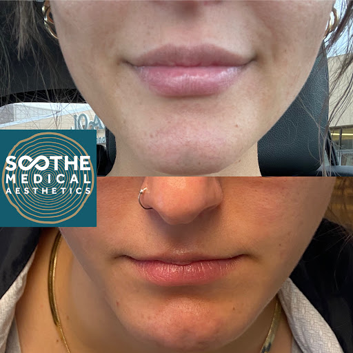 Soothe Medical Aesthetics