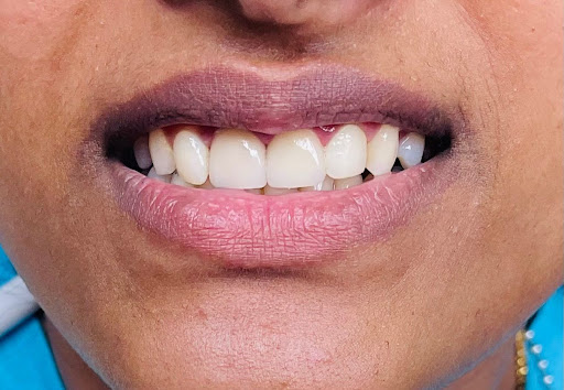 Dr. Nitender Kumar - Visual