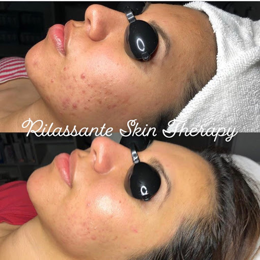 Rilassante Skin Therapy