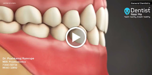 🌟 Dive into the marvels of dental craftsmanship with our Anatomy of a Tooth video! From crown to… post image
