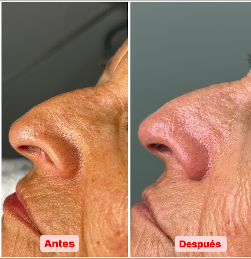 Centro de Depilación y Estética Oni Esthetic No+vello