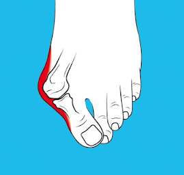 Photo n°12 de Docteur Charles FRANQUEVILLE Chirurgien orthopédiste à Vitry-sur-Seine (Chirurgien)