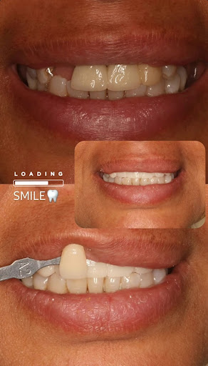 Dentista General - Dr Saenz