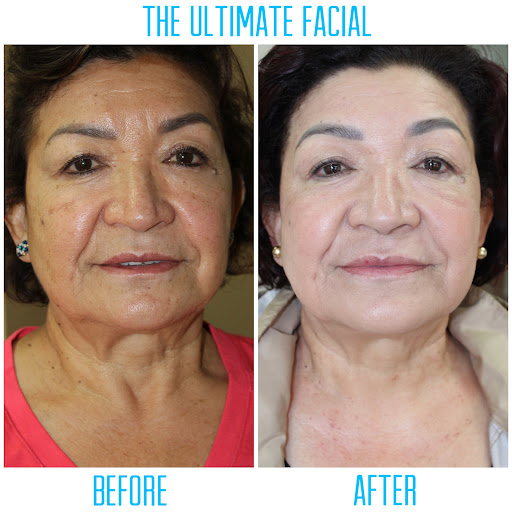 The Ultimate Facial - Thumbnail