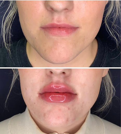 Slater Aesthetics & Anti-Aging