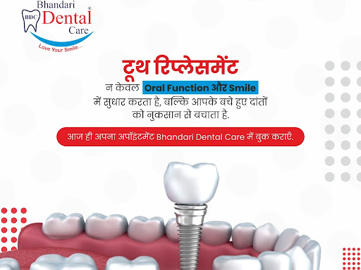 Dental Implant Camp post image