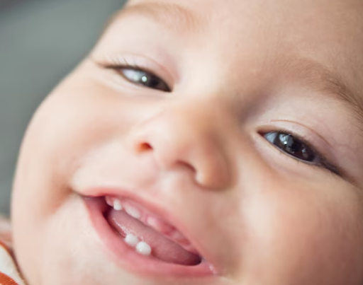 Tooth eruption is the natural process in which teeth emerge through the gums and become visible i… post image