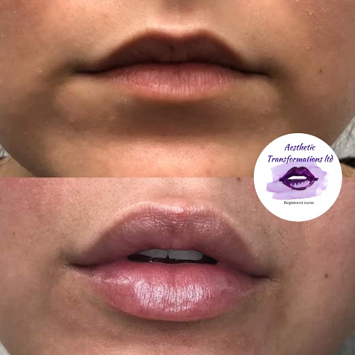 Aesthetic Transformations Ltd. - Visual