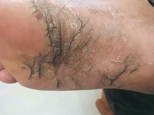 Cured within 3 weeks (Dr Soumya Dey's Clinic desk)  post image