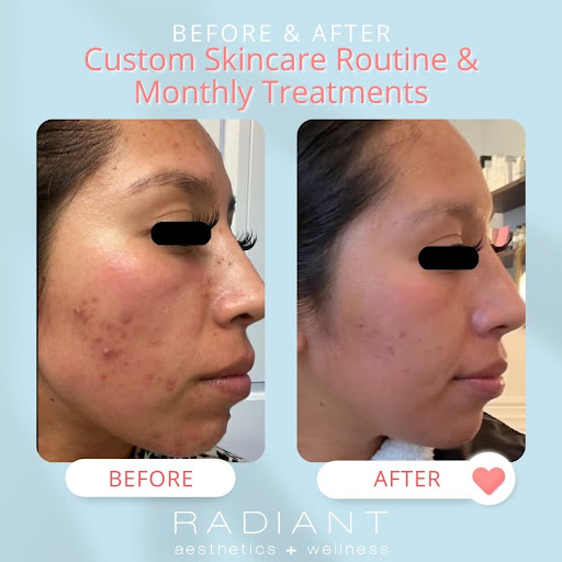 Radiant Aesthetics and Wellness - Thumbnail