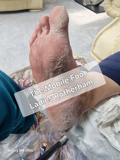 The Mobile Foot Ladies- Rotherham