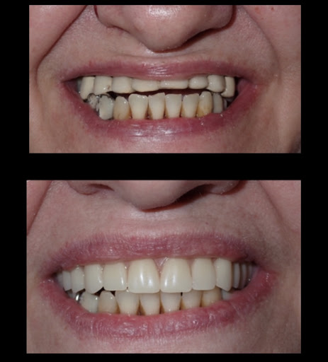 Denta Dental of Hobbs - Thumbnail