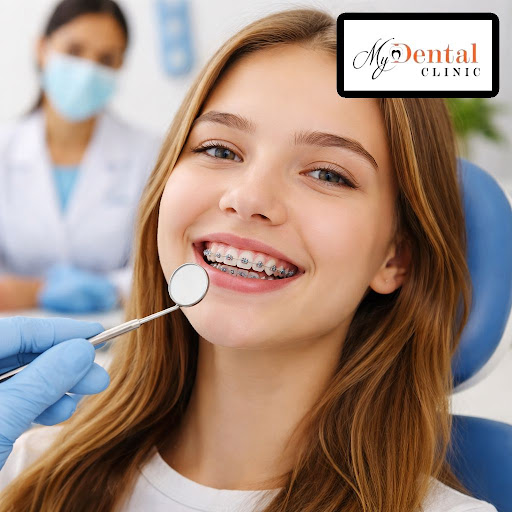 Thinking about getting braces but not sure if they’re worth it? At My Dental Clinic - Dr. Neha Ch… post image