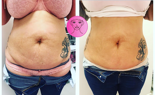 A & C Aesthetics Cheshire - Thumbnail